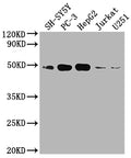 Western Blot
Positive WB detected in: SH-SY5Y whole cell lysate, PC3 whole cell lysate, HepG2 whole cell lysate, Jurkat whole cell lysate, U251 whole cell lysate
All lanes: EDG1 antibody at 1:2000
Secondary
Goat polyclonal to rabbit IgG at 1/50000 dilution
Predicted band size: 43 kDa
Observed band size: 43 kDa