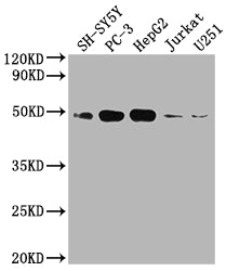Western Blot
Positive WB detected in: SH-SY5Y whole cell lysate, PC3 whole cell lysate, HepG2 whole cell lysate, Jurkat whole cell lysate, U251 whole cell lysate
All lanes: EDG1 antibody at 1:2000
Secondary
Goat polyclonal to rabbit IgG at 1/50000 dilution
Predicted band size: 43 kDa
Observed band size: 43 kDa