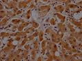 IHC image of CSB-RA925915A0HU diluted at 1:100 and staining in paraffin-embedded human liver tissue performed on a Leica BondTM system. After dewaxing and hydration, antigen retrieval was mediated by high pressure in a citrate buffer (pH 6.0) . Section was blocked with 10% normal goat serum 30min at RT. Then primary antibody (1% BSA) was incubated at 4℃ overnight. The primary is detected by a Goat anti-rabbit IgG polymer labeled by HRP and visualized using 0.05% DAB.