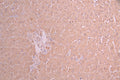 IHC image of CSB-RA926100A0HU diluted at 1:100 and staining in paraffin-embedded human liver cancer performed on a Leica BondTM system. After dewaxing and hydration, antigen retrieval was mediated by high pressure in a citrate buffer (pH 6.0) . Section was blocked with 10% normal goat serum 30min at RT. Then primary antibody (1% BSA) was incubated at 4°C overnight. The primary is detected by a Goat anti-rabbit polymer IgG labeled by HRP and visualized using 0.05% DAB.