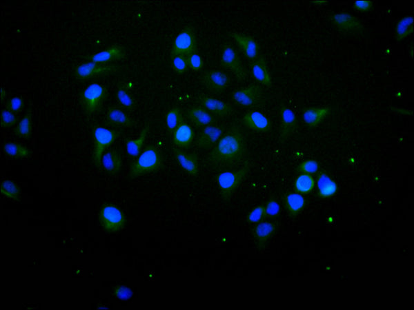 Immunofluorescence staining of HeLa cell with CSB-RA926576A0HU at 1:50 , counter-stained with DAPI. The cells were fixed in 4% formaldehyde, permeabilized using 0.2% Triton X-100 and blocked in 10% normal Goat Serum. The cells were then incubated with the antibody overnight at 4°C. The secondary antibody was Alexa Fluor 488-congugated AffiniPure Goat Anti-Rabbit IgG(H+L).