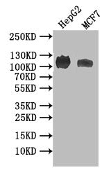 Western Blot
Positive WB detected in: HEPG2 whole cell lysate, MCF7 whole cell lysate
All lanes: ANPRB antibody at 1:1000
Secondary
Goat polyclonal to rabbit IgG at 1/50000 dilution
Predicted band size: 117 kDa
Observed band size: 117 kDa