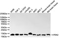 Western Blot
Positive WB detected in: A549 whole cell lysate(30µg) , THP-1 whole cell lysate(30µg) , SH-SY5Y whole cell lysate(30µg) , colo205 whole cell lysate(30µg) , PC-3 whole cell lysate(30µg) , A431 whole cell lysate(30µg) , MCF-7 whole cell lysate(30µg) , Mouse brain tissue lysate(30µg) , Rat brain tissue lysate(30µg) 
All lanes: PEN2 antibody at 1:1000
Secondary
Goat polyclonal to rabbit IgG at 1/40000 dilution
Predicted band size: 12 kDa
Observed band size: 12 kDa
Exposure time：2min
