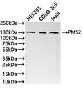 Western Blot
Positive WB detected in:HEK293 whole cell lysate(30µg) , COLO-205 whole cell lysate(30µg) , Hela whole cell lysate(30µg) 
All lanes: PMS2 antibody at 1:1000
Secondary
Goat polyclonal to rabbit IgG at 1/40000 dilution
Predicted band size: 96 kDa
Observed band size: 120 kDa
Exposure time：3min