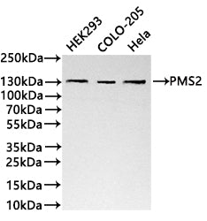 Western Blot
Positive WB detected in:HEK293 whole cell lysate(30µg) , COLO-205 whole cell lysate(30µg) , Hela whole cell lysate(30µg) 
All lanes: PMS2 antibody at 1:1000
Secondary
Goat polyclonal to rabbit IgG at 1/40000 dilution
Predicted band size: 96 kDa
Observed band size: 120 kDa
Exposure time：3min