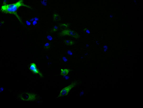 Immunofluorescence staining of HepG2 cell with CSB-RA928689A0HU at 1:50, counter-stained with DAPI. The cells were fixed in 4% formaldehyde, permeabilized using 0.2% Triton X-100 and blocked in 10% normal Goat Serum. The cells were then incubated with the antibody overnight at 4°C. The secondary antibody was Alexa Fluor 488-congugated AffiniPure Goat Anti-Rabbit IgG(H+L) .