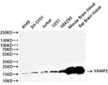 Western Blot
Positive WB detected in: A549 whole cell lysate(30µg), SH-SY5Y whole cell lysate(30µg), Jurkat whole cell lysate(30µg), U-251MG whole cell lysate(30µg), HEK293 whole cell lysate(30µg), Mouse brain tissue lysate(30µg), Rat brain tissue lysate(30µg)
All lanes:VAMP2 antibody at 1:1000
Secondary
Goat polyclonal to rabbit IgG at 1/40000 dilution
Predicted band size: 13 kDa
Observed band size: 16 kDa
Exposure time：2min