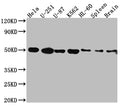 Western Blot
Positive WB detected in: Hela whole cell lysate, U-251 whole cell lysate, U-87 whole cell lysate, K562 whole cell lysate, HL-60 whole cell lysate, Rat Spleen whole cell lysate, Rat Brain whole cell lysate
All lanes: Dopamine Receptor D3 antibody at 1:1000
Secondary
Goat polyclonal to rabbit IgG at 1/50000 dilution
Predicted band size: 45, 41 kDa
Observed band size: 50 kDa