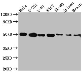 Western Blot
Positive WB detected in: Hela whole cell lysate, U-251 whole cell lysate, U-87 whole cell lysate, K562 whole cell lysate, HL-60 whole cell lysate, Rat Spleen whole cell lysate, Rat Brain whole cell lysate
All lanes: Dopamine Receptor D3 antibody at 1:1000
Secondary
Goat polyclonal to rabbit IgG at 1/50000 dilution
Predicted band size: 45, 41 kDa
Observed band size: 50 kDa