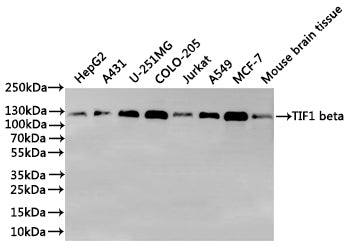 Western Blot
Positive WB detected in: HepG2 whole cell lysate(30µg), A431 whole cell lysate(30µg), U-251MG whole cell lysate(30µg), COLO-205 whole cell lysate(30µg), Jurkat whole cell lysate(30µg), A549 whole cell lysate(30µg), MCF-7 whole cell lysate(30µg), Mouse brain tissue lysate(30µg)
All lanes: TIF1 beta antibody at 1:1000
Secondary
Goat polyclonal to rabbit IgG at 1/40000 dilution
Predicted band size: 89 kDa
Observed band size: 122 kDa
Exposure time：1min