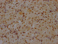 IHC image of CSB-RA930964A0HU diluted at 1:100 and staining in paraffin-embedded human ovarian tissue performed on a Leica BondTM system. After dewaxing and hydration, antigen retrieval was mediated by high pressure in a citrate buffer (pH 6.0) . Section was blocked with 10% normal goat serum 30min at RT. Then primary antibody (1% BSA) was incubated at 4℃ overnight. The primary is detected by a Goat anti-rabbit IgG polymer labeled by HRP and visualized using 0.05% DAB.