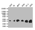 Western Blot
Positive WB detected in: 293T whole cell lysate, JK whole cell lysate, MCF7 whole cell lysate, A549 whole cell lysate, PC-3 whole cell lysate, K562 whole cell lysate
All lanes: Thymidine Kinase 1 antibody at 1:1000
Secondary
Goat polyclonal to rabbit IgG at 1/50000 dilution
Predicted band size: 26 kDa
Observed band size: 26 kDa