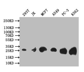Western Blot
Positive WB detected in: 293T whole cell lysate, JK whole cell lysate, MCF7 whole cell lysate, A549 whole cell lysate, PC-3 whole cell lysate, K562 whole cell lysate
All lanes: Thymidine Kinase 1 antibody at 1:1000
Secondary
Goat polyclonal to rabbit IgG at 1/50000 dilution
Predicted band size: 26 kDa
Observed band size: 26 kDa