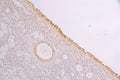 IHC image of CSB-RA932279MA1HU diluted at 1：100 and staining in paraffin-embedded human ovarian tissue performed on a Leica BondTM system. After dewaxing and hydration, antigen retrieval was mediated by high pressure in a citrate buffer (pH 6.0) . Section was blocked with 10% normal goat serum 30min at RT. Then primary antibody (1% BSA) was incubated at 4°C overnight. The primary is detected by a Goat anti-human polymer IgG labeled by HRP and visualized using 0.05% DAB.