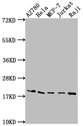 Western Blot
Positive WB detected in: A2780 whole cell lysate, Hela whole cell lysate, MCF-7 whole cell lysate, Jurkat whole cell lysate, Raji whole cell lysate
All lanes: EIF5A antibody at 1:2000
Secondary
Goat polyclonal to rabbit IgG at 1/50000 dilution
Predicted band size: 17, 21 kDa
Observed band size: 18 kDa