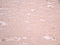 IHC image of CSB-RA932884A0HU diluted at 1:100 and staining in paraffin-embedded human brain tissue performed on a Leica BondTM system. After dewaxing and hydration, antigen retrieval was mediated by high pressure in a citrate buffer (pH 6.0). Section was blocked with 10% normal goat serum 30min at RT. Then primary antibody (1% BSA) was incubated at 4°C overnight. The primary is detected by a Goat anti-rabbit polymer IgG labeled by HRP and visualized using 0.05% DAB.