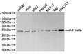 Western Blot
Positive WB detected in: Jurkat whole cell lysate(30µg) , Hela whole cell lysate(30µg) , K562 whole cell lysate(30µg) , HepG2 whole cell lysate(30µg) , MCF-7 whole cell lysate(30µg) , Raji whole cell lysate(30µg) , NIH/3T3 whole cell lysate(30µg) 
All lanes: IkB beta antibody at 1:1000
Secondary
Goat polyclonal to rabbit IgG at 1/40000 dilution
Predicted band size: 38 kDa
Observed band size: 48 kDa
Exposure time：1min