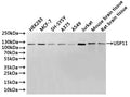 Western Blot
Positive WB detected in: HEK293 whole cell lysate(30µg), MCF-7 whole cell lysate(30µg), SH-SY5Y whole cell lysate(30µg), A375 whole cell lysate(30µg), A549 whole cell lysate(30µg), Jurkat whole cell lysate(30µg), Mouse brain tissue lysate(30µg), Rat brain tissue lysate(30µg)
All lanes: USP11 antibody at 1:1000
Secondary
Goat polyclonal to rabbit IgG at 1/40000 dilution
Predicted band size: 110 kDa
Observed band size: 110 kDa
Exposure time：2min