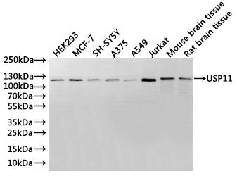 Western Blot
Positive WB detected in: HEK293 whole cell lysate(30µg), MCF-7 whole cell lysate(30µg), SH-SY5Y whole cell lysate(30µg), A375 whole cell lysate(30µg), A549 whole cell lysate(30µg), Jurkat whole cell lysate(30µg), Mouse brain tissue lysate(30µg), Rat brain tissue lysate(30µg)
All lanes: USP11 antibody at 1:1000
Secondary
Goat polyclonal to rabbit IgG at 1/40000 dilution
Predicted band size: 110 kDa
Observed band size: 110 kDa
Exposure time：2min