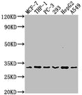 Western Blot
Positive WB detected in: MCF-7 whole cell lysate, THP-1 whole cell lysate, PC-3 whole cell lysate, 293 whole cell lysate, HepG2 whole cell lysate, A549 whole cell lysate
All lanes: CD8A antibody at 1:2000
Secondary
Goat polyclonal to rabbit IgG at 1/50000 dilution
Predicted band size: 26, 22, 31 kDa
Observed band size: 31 kDa