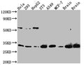 Western Blot
Positive WB detected in: Hela whole cell lysate, 293 whole cell lysate, HepG2 whole cell lysate, NIH/3T3 whole cell lysate, A549 whole cell lysate, MCF-7 whole cell lysate, Mouse Brain whole cell lysate, Rat Brain whole cell lysate
All lanes: PGAM1 Antibody at 1:1000
Secondary
Goat polyclonal to rabbit IgG at 1/50000 dilution
Predicted band size: 28 kDa
Observed band size: 29 kDa