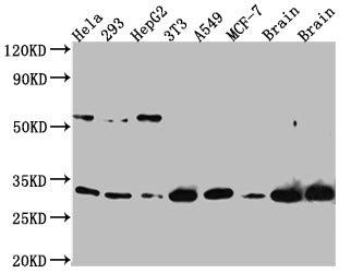 Western Blot
Positive WB detected in: Hela whole cell lysate, 293 whole cell lysate, HepG2 whole cell lysate, NIH/3T3 whole cell lysate, A549 whole cell lysate, MCF-7 whole cell lysate, Mouse Brain whole cell lysate, Rat Brain whole cell lysate
All lanes: PGAM1 Antibody at 1:1000
Secondary
Goat polyclonal to rabbit IgG at 1/50000 dilution
Predicted band size: 28 kDa
Observed band size: 29 kDa