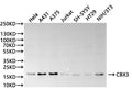 Western Blot
Positive WB detected in: Hela whole cell lysate(30µg), A431 whole cell lysate(30µg), A375 whole cell lysate(30µg), Jurkat whole cell lysate(30µg), SH-SY5Y whole cell lysate(30µg), HT-29 whole cell lysate(30µg), NIH/3T3 whole cell lysate(30µg)
All lanes: CBX3 antibody at 1:1000
Secondary
Goat polyclonal to rabbit IgG at 1/40000 dilution
Predicted band size: 24 kDa
Observed band size: 21 kDa
Exposure time：2min40s