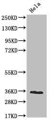 Western Blot
Positive WB detected in: Hela whole cell lysate
All lanes: NUDT5 antibody at 1:2000
Secondary
Goat polyclonal to rabbit IgG at 1/50000 dilution
Predicted band size: 25 kDa
Observed band size: 36 kDa
