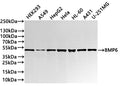 Western Blot
Positive WB detected in: HEK293 whole cell lysate(30µg) , A549 whole cell lysate(30µg) , HepG2 whole cell lysate(30µg) , Hela whole cell lysate(30µg) , HL-60 whole cell lysate(30µg) , A431 whole cell lysate(30µg) , U-251MG whole cell lysate(30µg) 
All lanes: BMP6 antibody at 1:1000
Secondary
Goat polyclonal to rabbit IgG at 1/40000 dilution
Predicted band size: 57 kDa
Observed band size: 52 kDa
Exposure time：1min20s