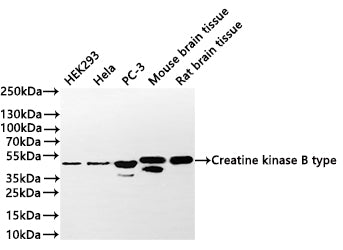Western Blot
Positive WB detected in: HEK293 whole cell lysate(30µg) ,Hela whole cell lysate(30µg) , PC-3 whole cell lysate(30µg) ,Mouse brain tissue lysate(30µg) ,Rat brain tissue lysate(30µg) 
All lanes: Creatine kinase B type antibody at 1:1000
Secondary
Goat polyclonal to rabbit IgG at 1/40000 dilution
Predicted band size: 43 kDa
Observed band size: 48 kDa
Exposure time：2min