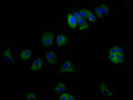 Immunofluorescence staining of MCF7 Cells with CSB-RA937008A0HU at 1:50, counter-stained with DAPI. The cells were fixed in 4% formaldehyde and blocked in 10% normal Goat Serum. The cells were then incubated with the antibody overnight at 4℃. Nuclear DNA was labeled in blue with DAPI. The secondary antibody was FITC-conjugated AffiniPure Goat Anti-Rabbit IgG (H+L) .
