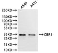 Western Blot
Positive WB detected in: A549 whole cell lysate(30µg), A431 whole cell lysate(30µg)
All lanes: CBR1 antibody at 1:1000
Secondary
Goat polyclonal to rabbit IgG at 1/40000 dilution
Predicted band size: 30 kDa
Observed band size: 35 kDa
Exposure time：20s