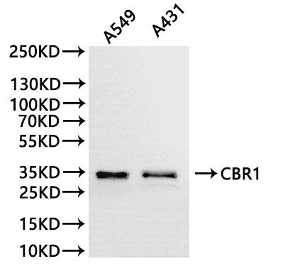 Western Blot
Positive WB detected in: A549 whole cell lysate(30µg), A431 whole cell lysate(30µg)
All lanes: CBR1 antibody at 1:1000
Secondary
Goat polyclonal to rabbit IgG at 1/40000 dilution
Predicted band size: 30 kDa
Observed band size: 35 kDa
Exposure time：20s