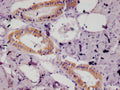 IHC image of CSB-RA937491A0HU diluted at 1:100 and staining in paraffin-embedded human salivary gland tissue performed on a Leica BondTM system. After dewaxing and hydration, antigen retrieval was mediated by high pressure in a citrate buffer (pH 6.0) . Section was blocked with 10% normal goat serum 30min at RT. Then primary antibody (1% BSA) was incubated at 4°C overnight. The primary is detected by a Goat anti-rabbit polymer IgG labeled by HRP and visualized using 0.05% DAB.