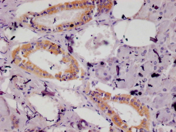 IHC image of CSB-RA937491A0HU diluted at 1:100 and staining in paraffin-embedded human salivary gland tissue performed on a Leica BondTM system. After dewaxing and hydration, antigen retrieval was mediated by high pressure in a citrate buffer (pH 6.0) . Section was blocked with 10% normal goat serum 30min at RT. Then primary antibody (1% BSA) was incubated at 4°C overnight. The primary is detected by a Goat anti-rabbit polymer IgG labeled by HRP and visualized using 0.05% DAB.