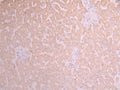 IHC image of CSB-RA938641A0HU diluted at 1:100 and staining in paraffin-embedded human liver cancer performed on a Leica BondTM system. After dewaxing and hydration, antigen retrieval was mediated by high pressure in a citrate buffer (pH 6.0) . Section was blocked with 10% normal goat serum 30min at RT. Then primary antibody (1% BSA) was incubated at 4°C overnight. The primary is detected by a Goat anti-rabbit polymer IgG labeled by HRP and visualized using 0.05% DAB.