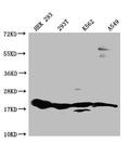 Western Blot
Positive WB detected in: HEK293 whole cell lysate, 293T whole cell lysate, K562 whole cell lysate, A549 whole cell lysate
All lanes: RPS19 antibody at 1:1000
Secondary
Goat polyclonal to rabbit IgG at 1/50000 dilution
Predicted band size: 17 kDa
Observed band size: 15-20 kDa