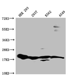 Western Blot
Positive WB detected in: HEK293 whole cell lysate, 293T whole cell lysate, K562 whole cell lysate, A549 whole cell lysate
All lanes: RPS19 antibody at 1:1000
Secondary
Goat polyclonal to rabbit IgG at 1/50000 dilution
Predicted band size: 17 kDa
Observed band size: 15-20 kDa