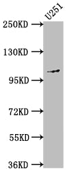 MME Antibody – Figure 1 of 1