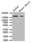 Western Blot
Positive WB detected in: JK whole cell lysate, Mouse Brain tissue lysate
All lanes: VEGF Receptor 1 antibody at 1:500
Secondary
Goat polyclonal to rabbit IgG at 1/50000 dilution
Predicted band size: 150 kDa
Observed band size: 150 kDa