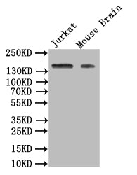 Western Blot
Positive WB detected in: JK whole cell lysate, Mouse Brain tissue lysate
All lanes: VEGF Receptor 1 antibody at 1:500
Secondary
Goat polyclonal to rabbit IgG at 1/50000 dilution
Predicted band size: 150 kDa
Observed band size: 150 kDa