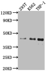 Western Blot
Positive WB detected in: 293T whole cell lysate, K562 whole cell lysate, THP-1 whole cell lysate
All lanes: Islet1 antibody at 1:1000
Secondary
Goat polyclonal to rabbit IgG at 1/50000 dilution
Predicted band size: 40 kDa
Observed band size: 40 kDa