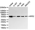 Western Blot
Positive WB detected in: Jurkat whole cell lysate(30µg) , U-937 whole cell lysate(30µg) , HL-60 whole cell lysate(30µg) , Hela whole cell lysate(30µg) , NIH/3T3 whole cell lysate(30µg) 
All lanes: NFE2 antibody at 1:1000
Secondary
Goat polyclonal to rabbit IgG at 1/40000 dilution
Predicted band size: 41 kDa
Observed band size: 50 kDa
Exposure time：3min