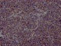 EZH2 Antibody – Figure 1 of 1