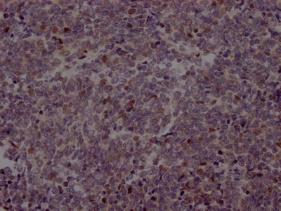 EZH2 Antibody – Figure 1 of 1