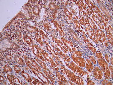 IHC image of CSB-RA943053A0HU diluted at 1:100 and staining in paraffin-embedded human stomach tissue performed on a Leica BondTM system. After dewaxing and hydration, antigen retrieval was mediated by high pressure in a citrate buffer (pH 6.0). Section was blocked with 10% normal goat serum 30min at RT. Then primary antibody (1% BSA) was incubated at 4°C overnight. The primary is detected by a Goat anti-rabbit polymer IgG labeled by HRP and visualized using 0.05% DAB.
