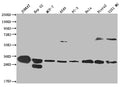 Western Blot
Positive WB detected in: Jurkat whole cell lysate, HepG2 whole cell lysate, MCF-7 whole cell lysate, A549 whole cell lysate, PC3 whole cell lysate, Hela whole cell lysate, Ntera-2 whole cell lysate, U251 whole cell lysate
All lanes: PSME1 antibody at 1:2000
Secondary
Goat polyclonal to rabbit IgG at 1/50000 dilution
Predicted band size: 29, 27 kDa
Observed band size: 28-30, 55-72 kDa
