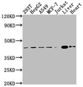 Western Blot
Positive WB detected in: 293T whole cell lysate, HepG2 whole cell lysate, A549 whole cell lysate, MCF-7 whole cell lysate, Jurkat whole cell lysate, Mouse liver tissue, Mouse heart tissue
All lanes: AGTR2 antibody at 1:2000
Secondary
Goat polyclonal to rabbit IgG at 1/50000 dilution
Predicted band size: 42 kDa
Observed band size: 42 kDa