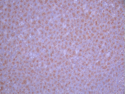 IHC image of CSB-RA944215A0HU diluted at 1:100 and staining in paraffin-embedded human tonsil tissue performed on a Leica BondTM system. After dewaxing and hydration, antigen retrieval was mediated by high pressure in a citrate buffer (pH 6.0). Section was blocked with 10% normal goat serum 30min at RT. Then primary antibody (1% BSA) was incubated at 4°C overnight. The primary is detected by a Goat anti-rabbit polymer IgG labeled by HRP and visualized using 0.05% DAB.