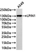 Western Blot
Positive WB detected in: A549 whole cell lysate(30µg) 
All lanes: LPIN1 antibody at 1:1000
Secondary
Goat polyclonal to rabbit IgG at 1/40000 dilution
Predicted band size: 99 kDa
Observed band size: 130 kDa
Exposure time：3min